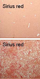Sirius red染色