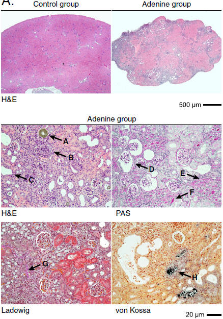 adenine-induced-renal-damages
